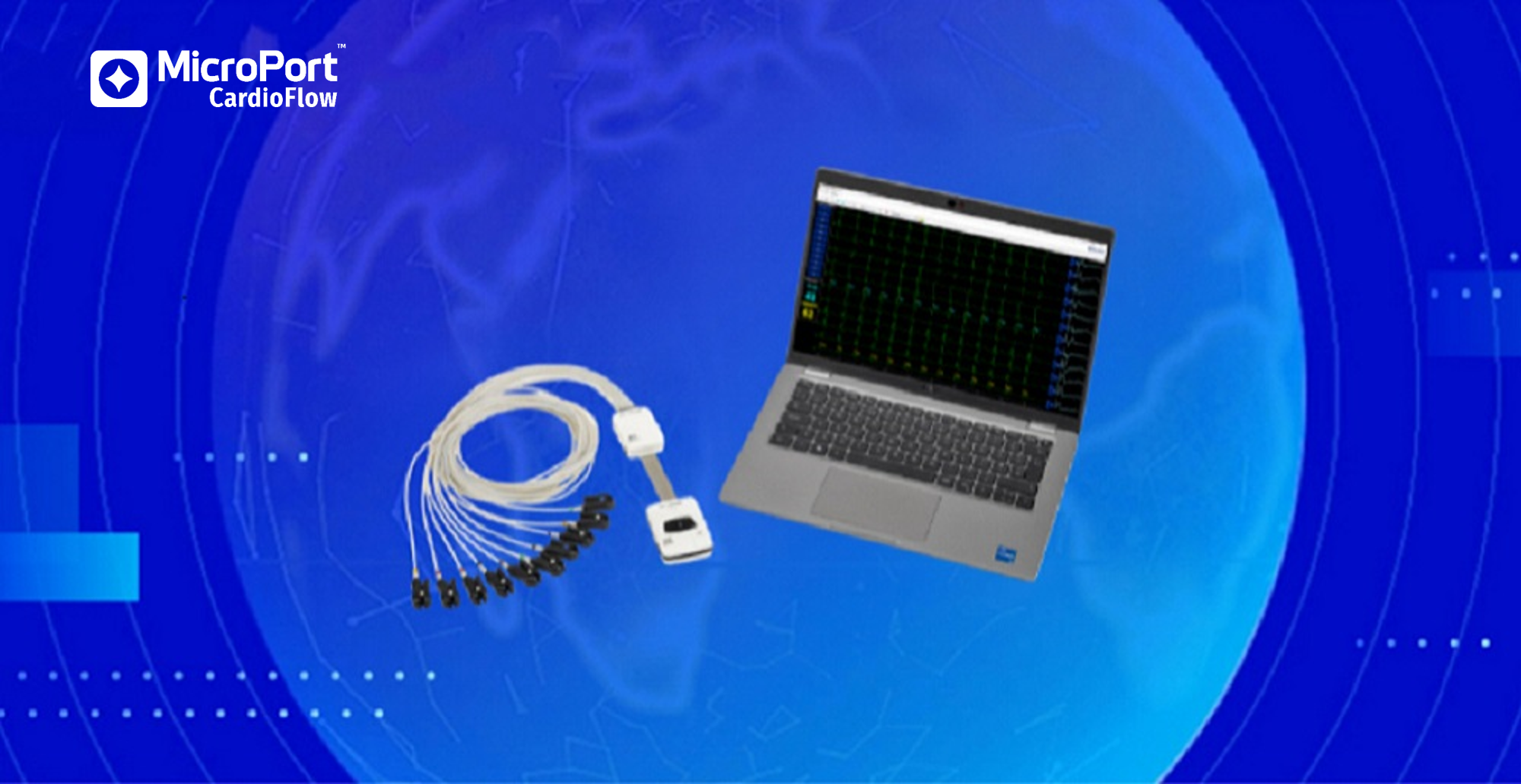 MicroPort CardioFlow Announces Commercial Launch of LBBOT Solution<sup>1</sup>, a Portable Real-Time ECG for Pacing Procedures, in Europe and Australia